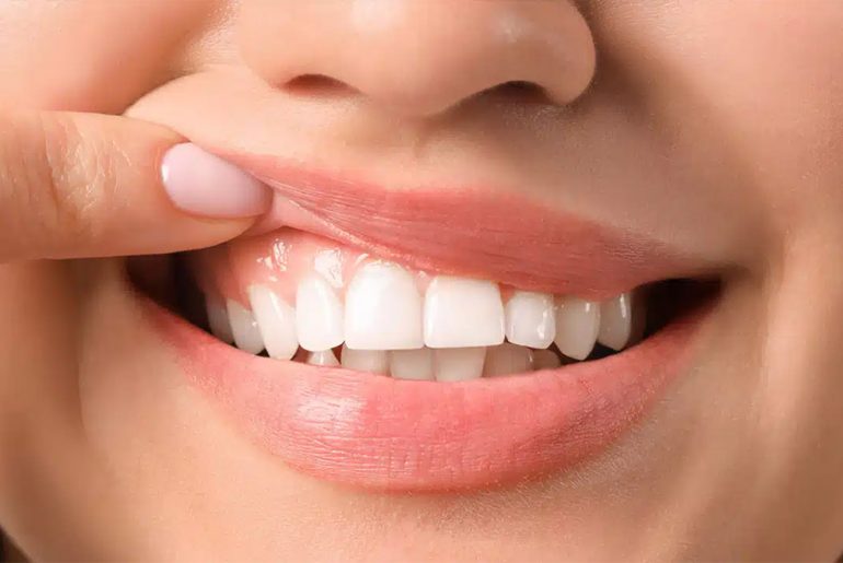 Foods to Consume to have Bright and Healthy Teeth